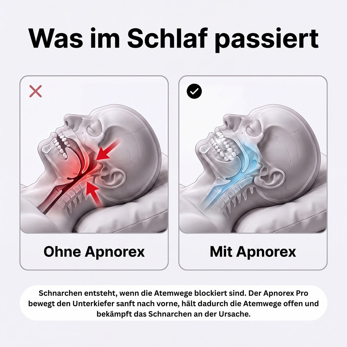 Apnorex Pro