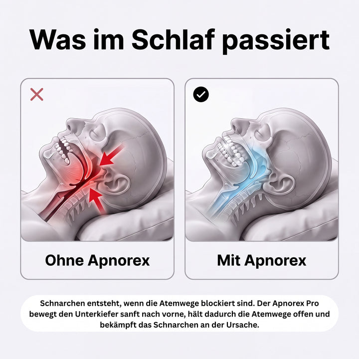 Apnorex Pro